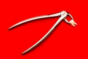 Die umgekehrte Zahnfee